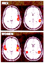 Men/Women Brain Scan
